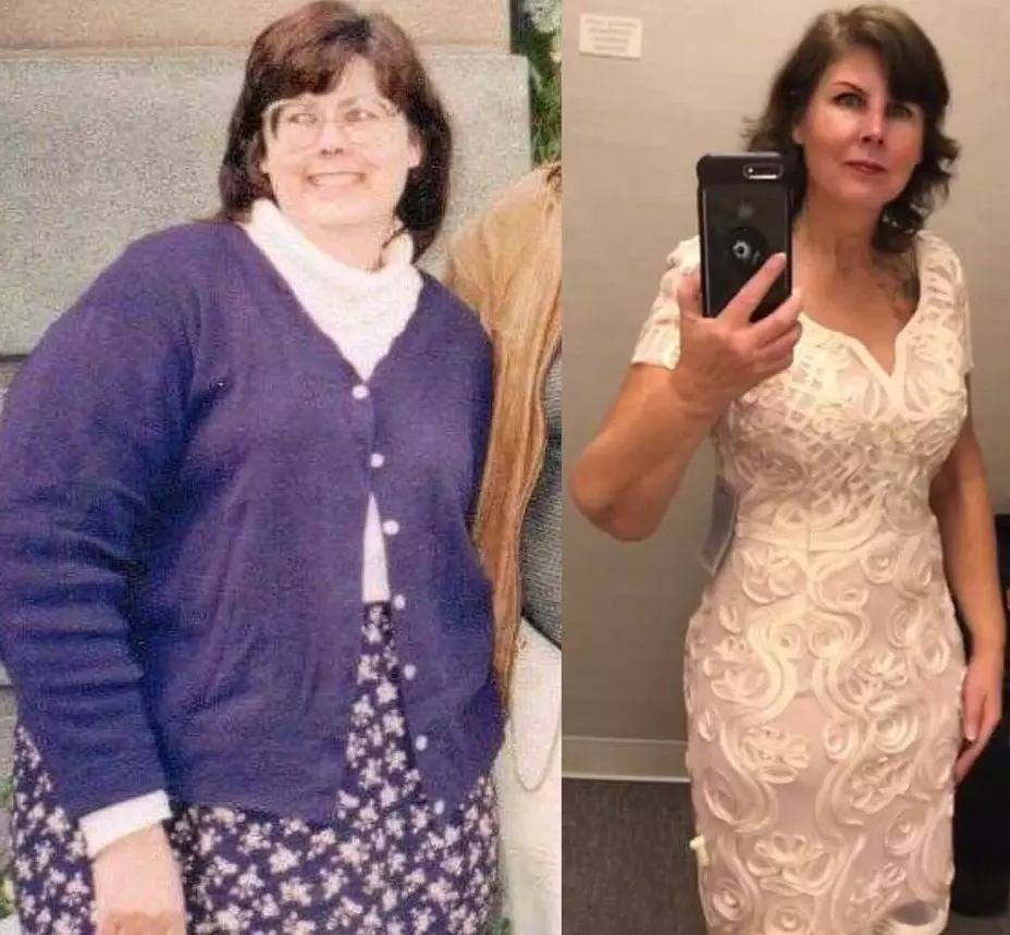 Jacque, before and after 80 lbs weight loss